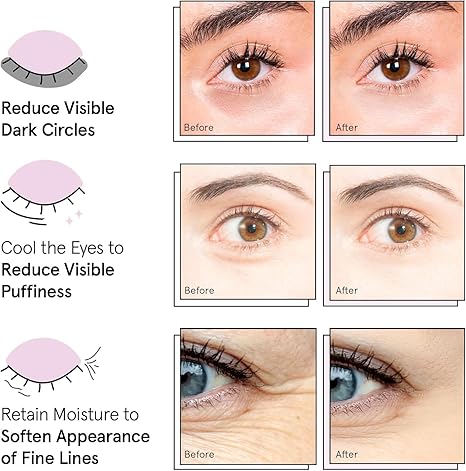 grace & stella Award Winning Under Eye Mask (Blue, 24 Pairs) Reduce Dark Circles