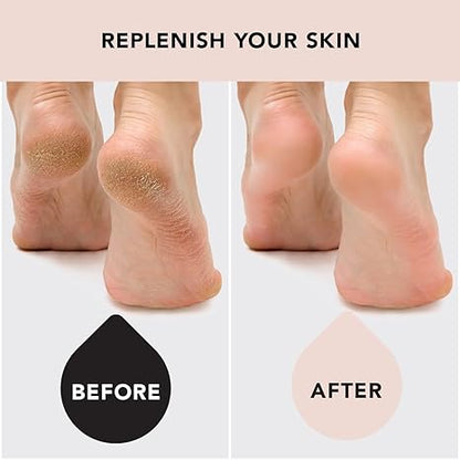 Kitsch Moisturizing Socks for Cracked Heel Treatment