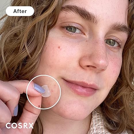 COSRX Acne Pimple Patch Absorbing Hydrocolloid Original 3 Size Patches for Blemishes and Zits Cover